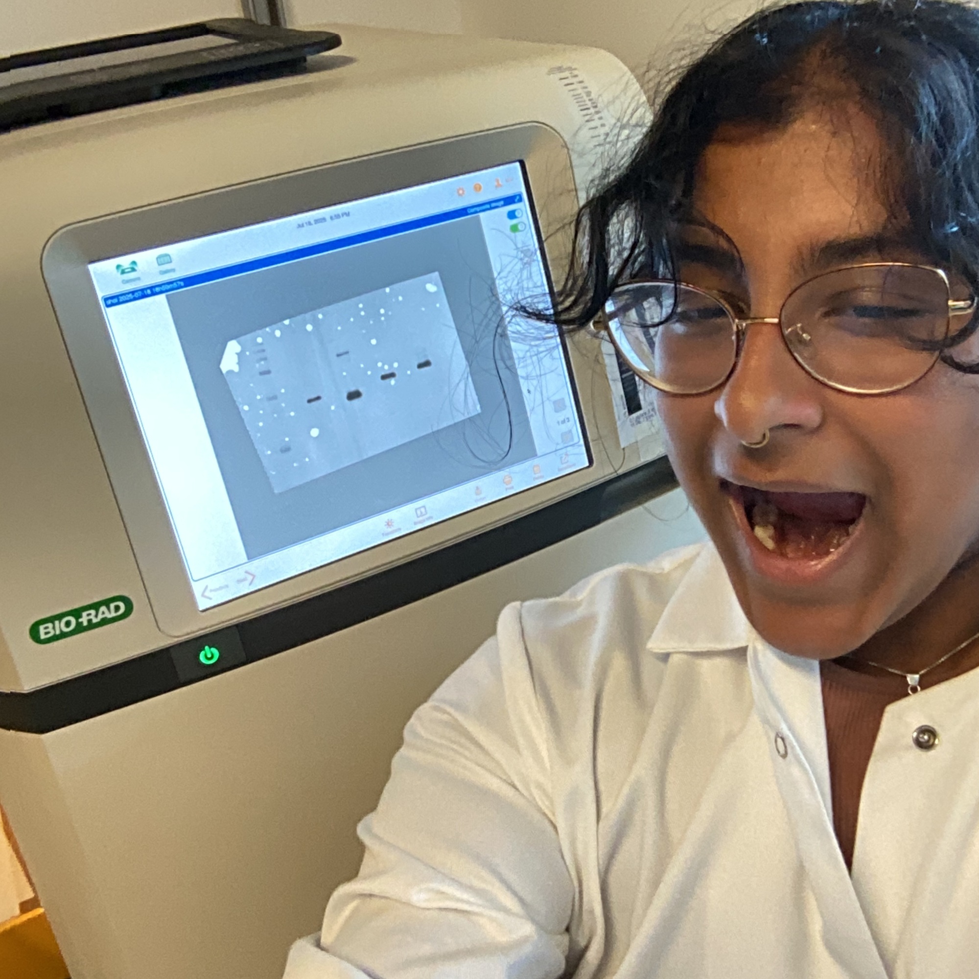 Shoili images the first Western Blot for the lab